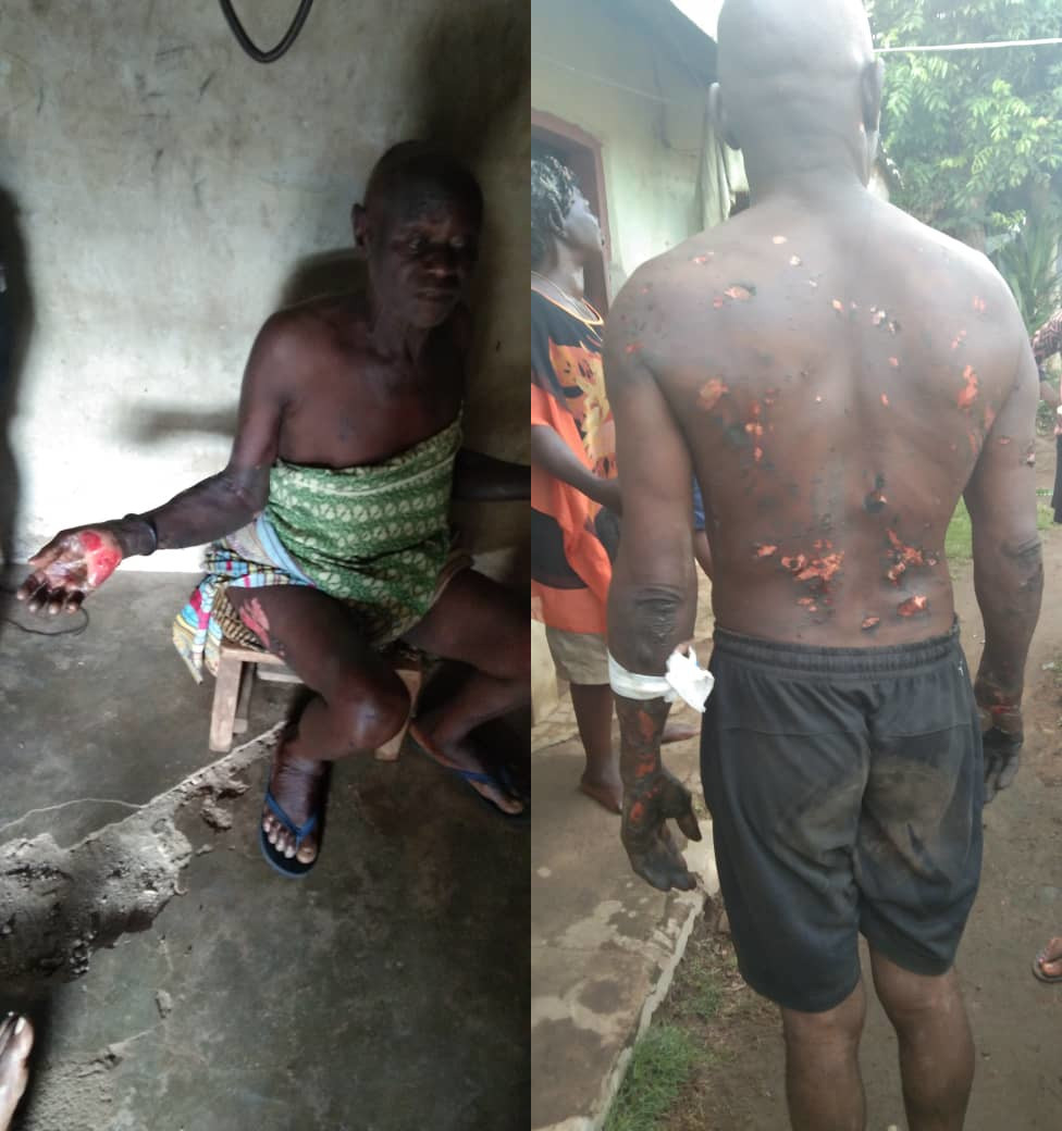 Special Adviser To Cross Rivers State Govt. Allegedly Burn Locals With Fire