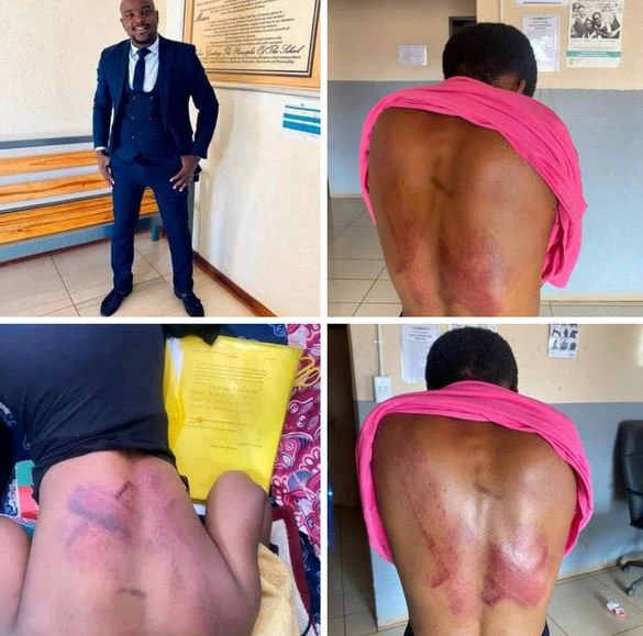 Female Student Brutally Flogged By School Resident Pastor For Being Late To Sunday Church Service (Photos)